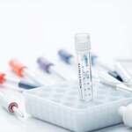 PCR-TEST, Definition, Aufgabe, ungeignet für Diagnosen, keine Nachweise, CT-Wert