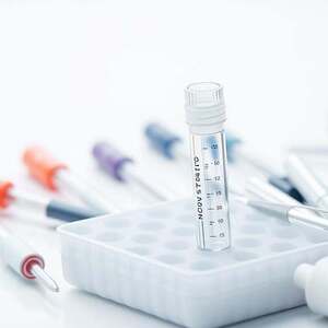 PCR-TEST, Definition, Aufgabe, ungeignet für Diagnosen, keine Nachweise, CT-Wert