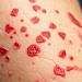 Neurodermitis, atopische Dermatitis, Hautentzündung, Ursachen, Heilmittel