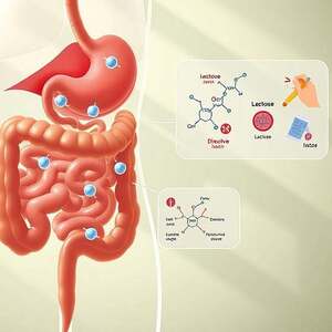 laktoseintoleranz, enzymmangel, ganzheitliche medizin, naturheilkunde, ernährung